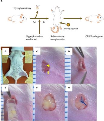 Subcutaneous transplantation of human embryonic stem cells-derived pituitary organoids